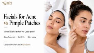 Facials for Acne vs Pimple Patches Comparison