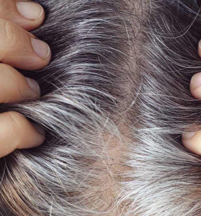 Grey hair Coverage